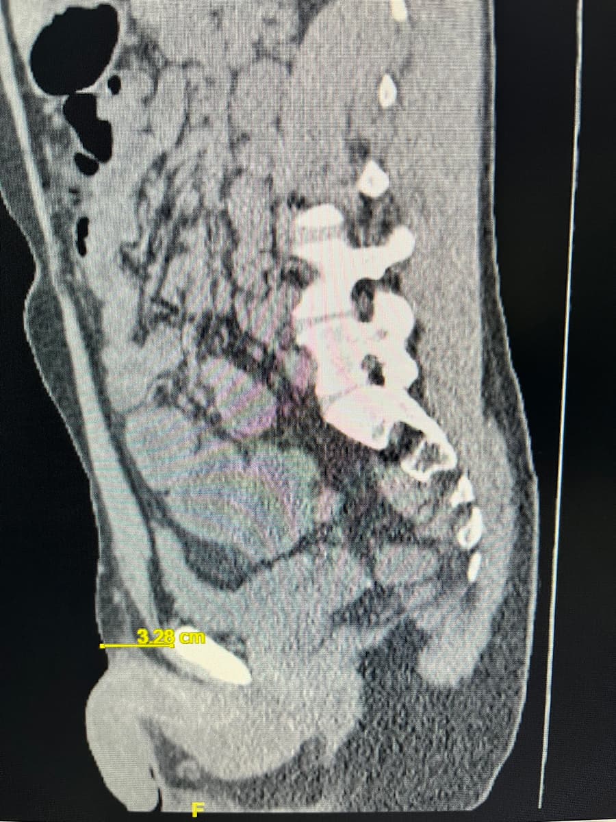 Side (or sagittal) view of a man’s abdomen and pelvis